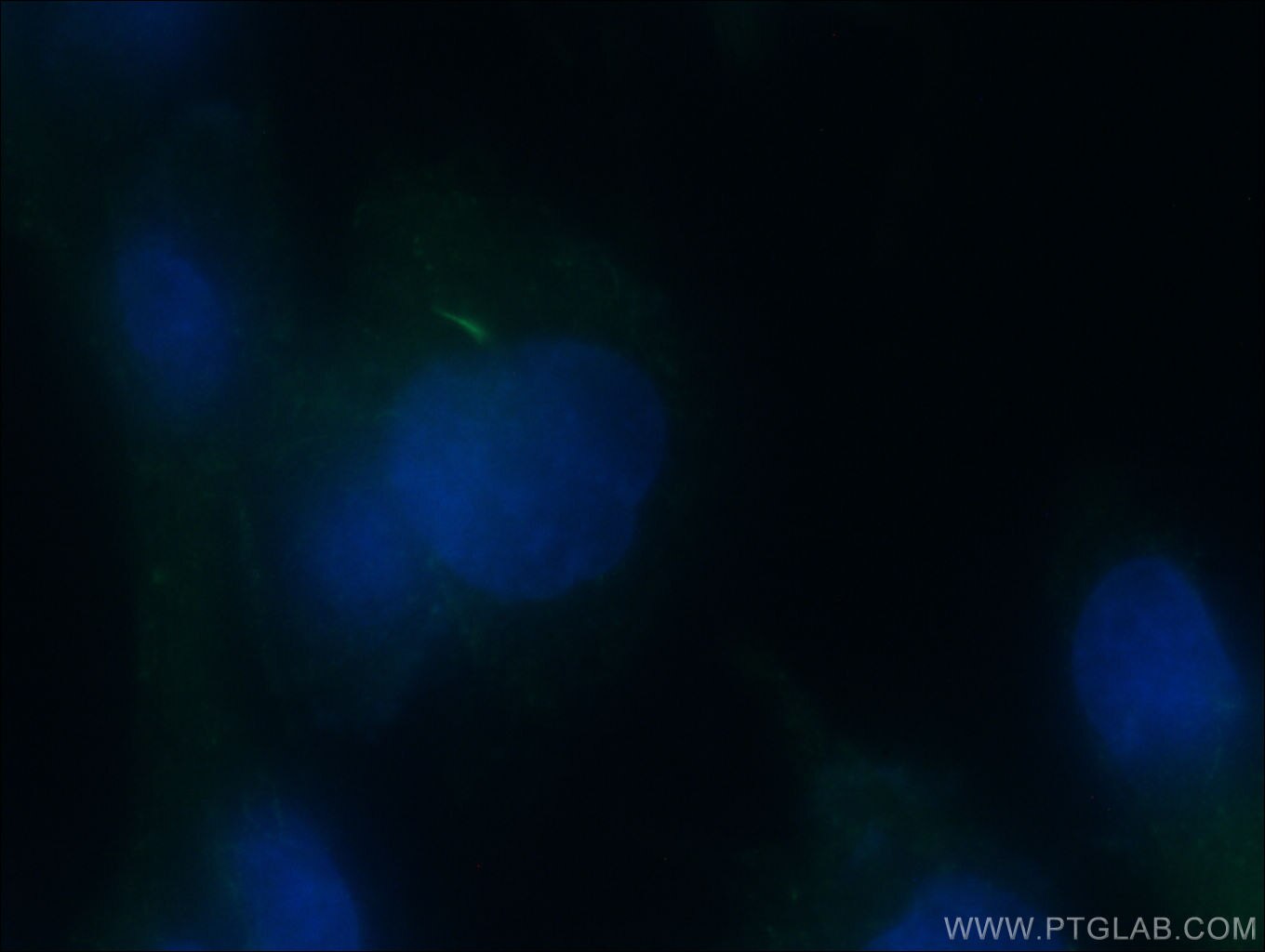 acetylated Tubulin(Lys40)