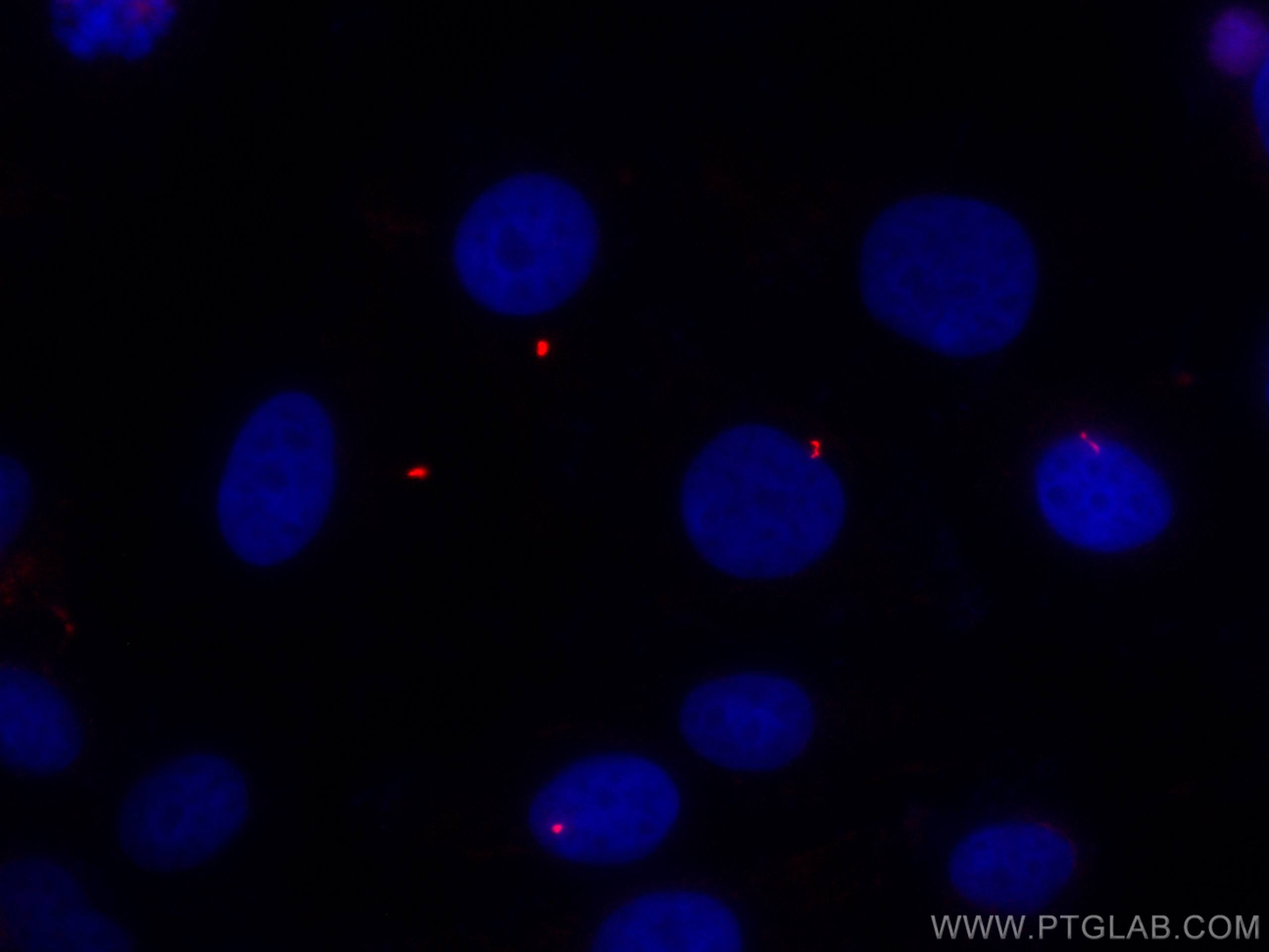 Immunofluorescence (IF) / fluorescent staining of MDCK cells using CoraLite®555-conjugated acetylated Tubulin(Lys40)  (CL555-66200)