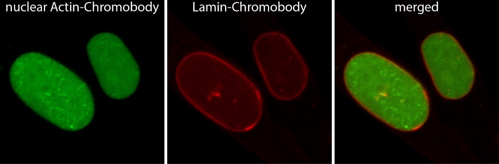 The time lapse analysis reveals the reorganization of actin after treatment with Cytochalasin D: HeLa cells were subjected to confocal imaging upon treatment with 2 µM of Cytochalasin D for 1 hour and recovery for 4 hours. Actin Chromobody enables monitoring of actin dynamics in real-time in living cells.