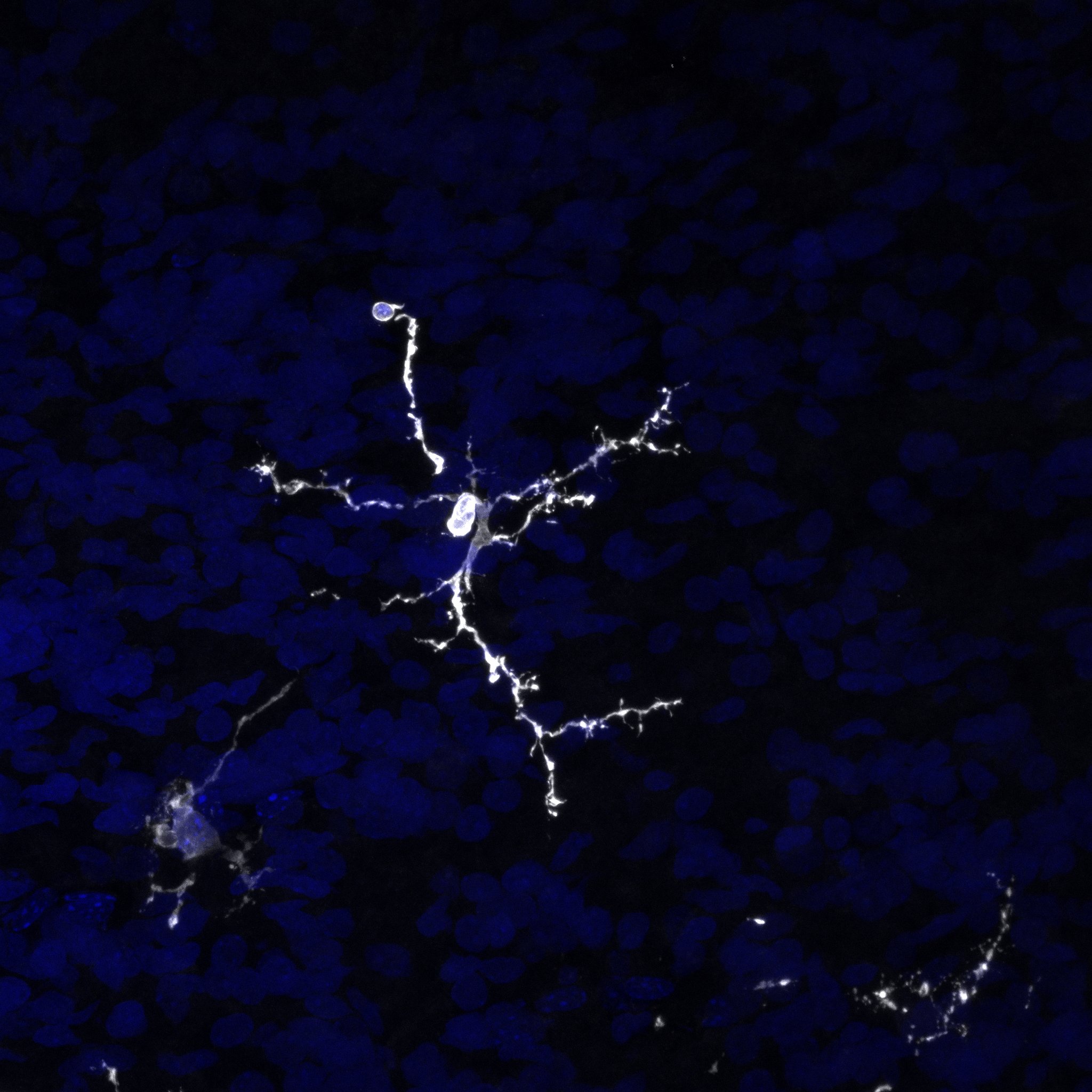 Human iPSC-derived microglia (white) residing within an in vivo brain-like organoid environment (blue) derived using HumanKine growth factors (TGF beta 1- HZ-1011, BMP4- HZ-1045, and Thrombopoietin HZ-1248).(Credits- Credit: Simon T. Schafer & Monique Pena, Technical University of Munich, Center for Organoid Systems)