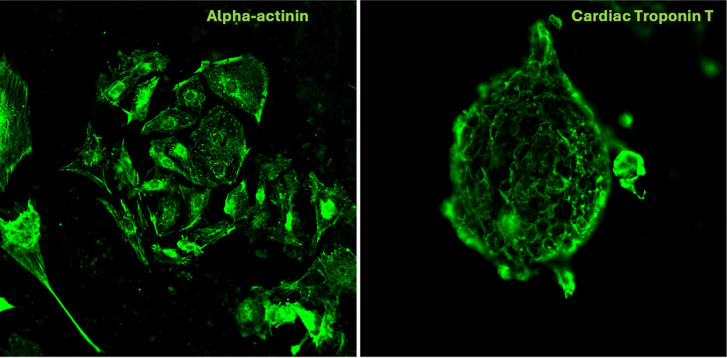 iPSC-derived Cardiomyocytes Cultured using Recombinant Human Activin A, BMP-4 and bFGF/FGF-2).​
 iPSCs differentiated to Cardiomyocytes using HumanKine® recombinant human Activin A
protein (HZ-1138), HumanKine® recombinant human BMP-4 protein (HZ-1045), HumanKine® recombinant human bFGF/FGF-2
(HZ-1285), were fixed and permeabilized for detection of endogenous Alpha actinin and Cardiac Troponin T using Alpha Actinin
Polyclonal Antibody (Product # 11313-2-AP, 1:200 dilution, labelled with CoraLite®594-Conjugated Goat Anti-Rabbit IgG(H+L)
(SA00013-4)) and Cardiac Troponin T Polyclonal Antibody (Product # 15513-1-AP, 1:200 dilution, labelled with CoraLite®488-
Conjugated AffiniPure Goat Anti-Rabbit IgG(H+L) (SA00013-2)).