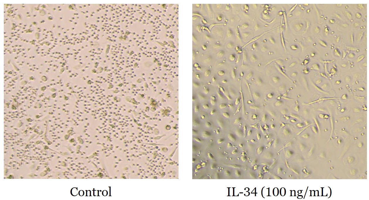 Human PBMC cells were seeded at a density of 100,000 cells per well in a non-tissue culture treated ​96-well plate. Cells were cultured in RPMI1640 + 10% FBS treated 100 ng/mL of Proteintech recombinant IL-34 (HZ-1316) for 6 days.