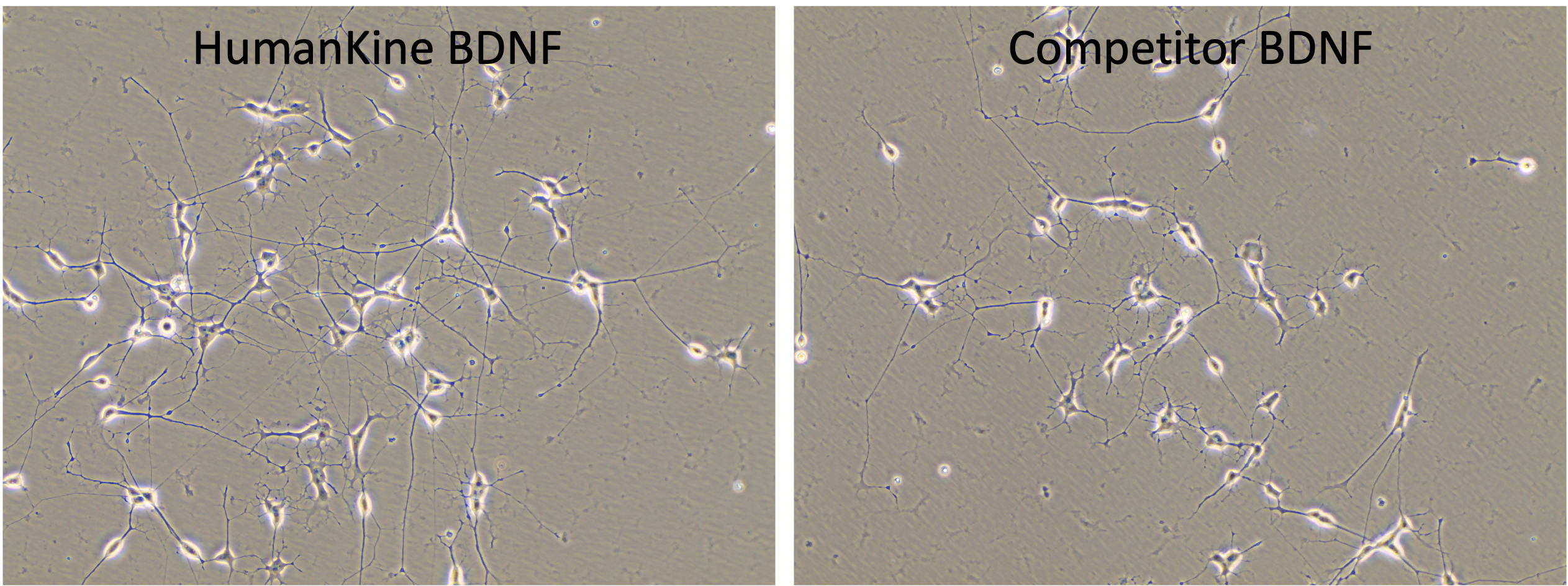 Differentiation of SHSY5Y cells into neurons using HumanKine BDNF in the presence of Retinoic acid. The data demonstrates significantly better neuronal differentiation using HumanKine BDNF compared to leading competitor in the market. 