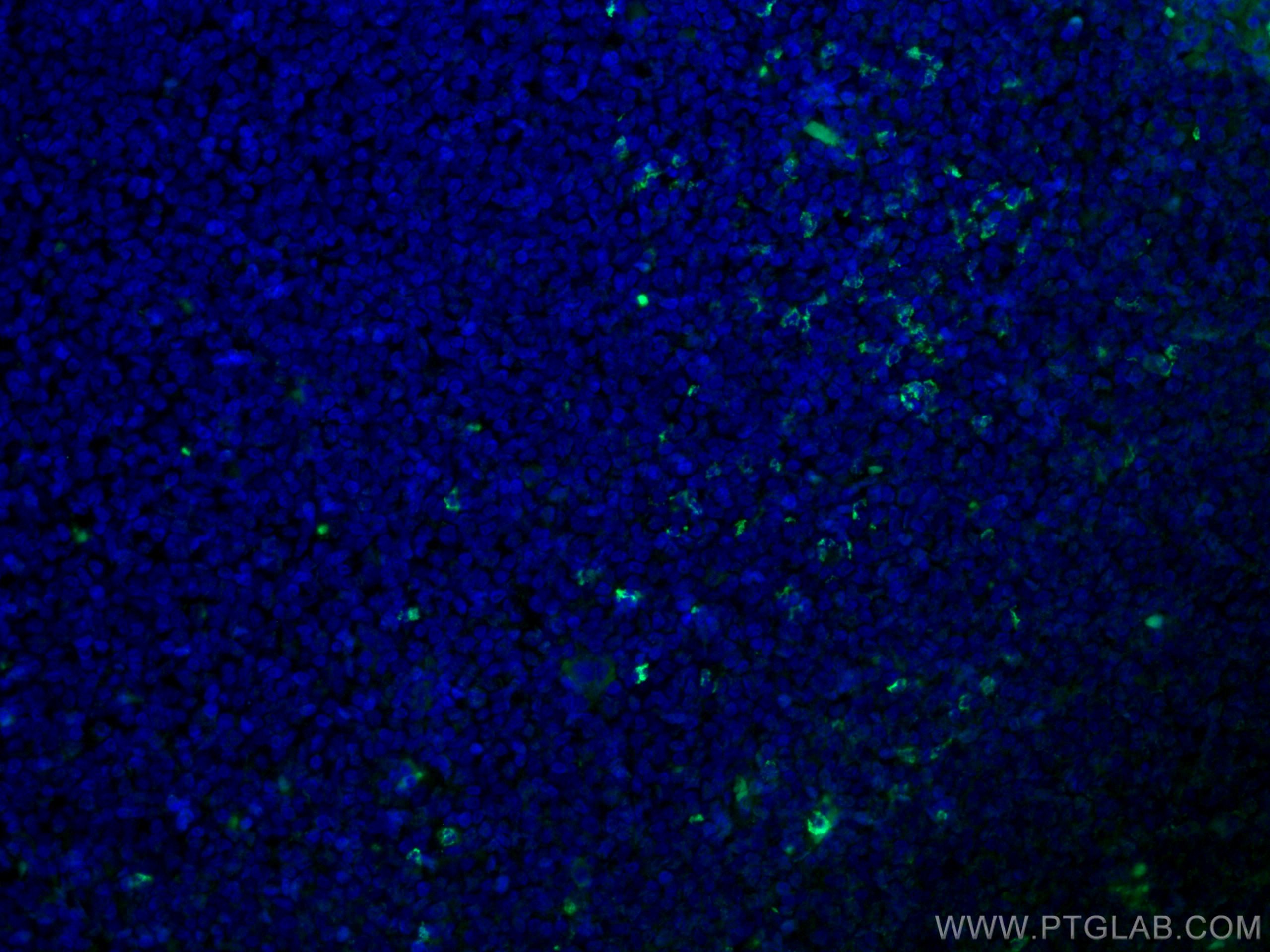 Immunofluorescence (IF) / fluorescent staining of human tonsillitis tissue using CoraLite® Plus 488-conjugated Alpha Antichymotryps (CL488-66078)