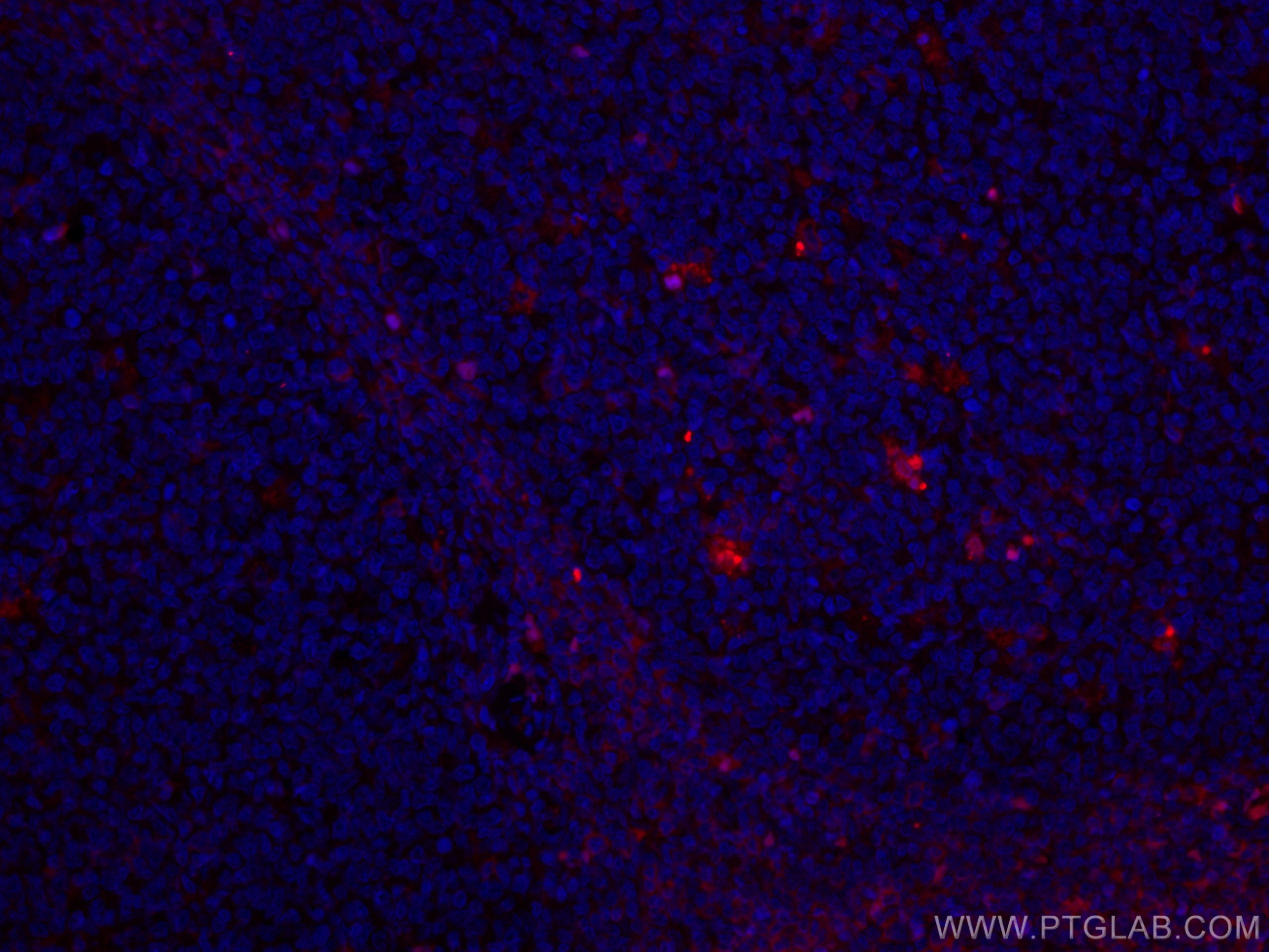 Immunofluorescence (IF) / fluorescent staining of human tonsillitis tissue using CoraLite®594-conjugated Alpha Antichymotrypsin Mon (CL594-66078)