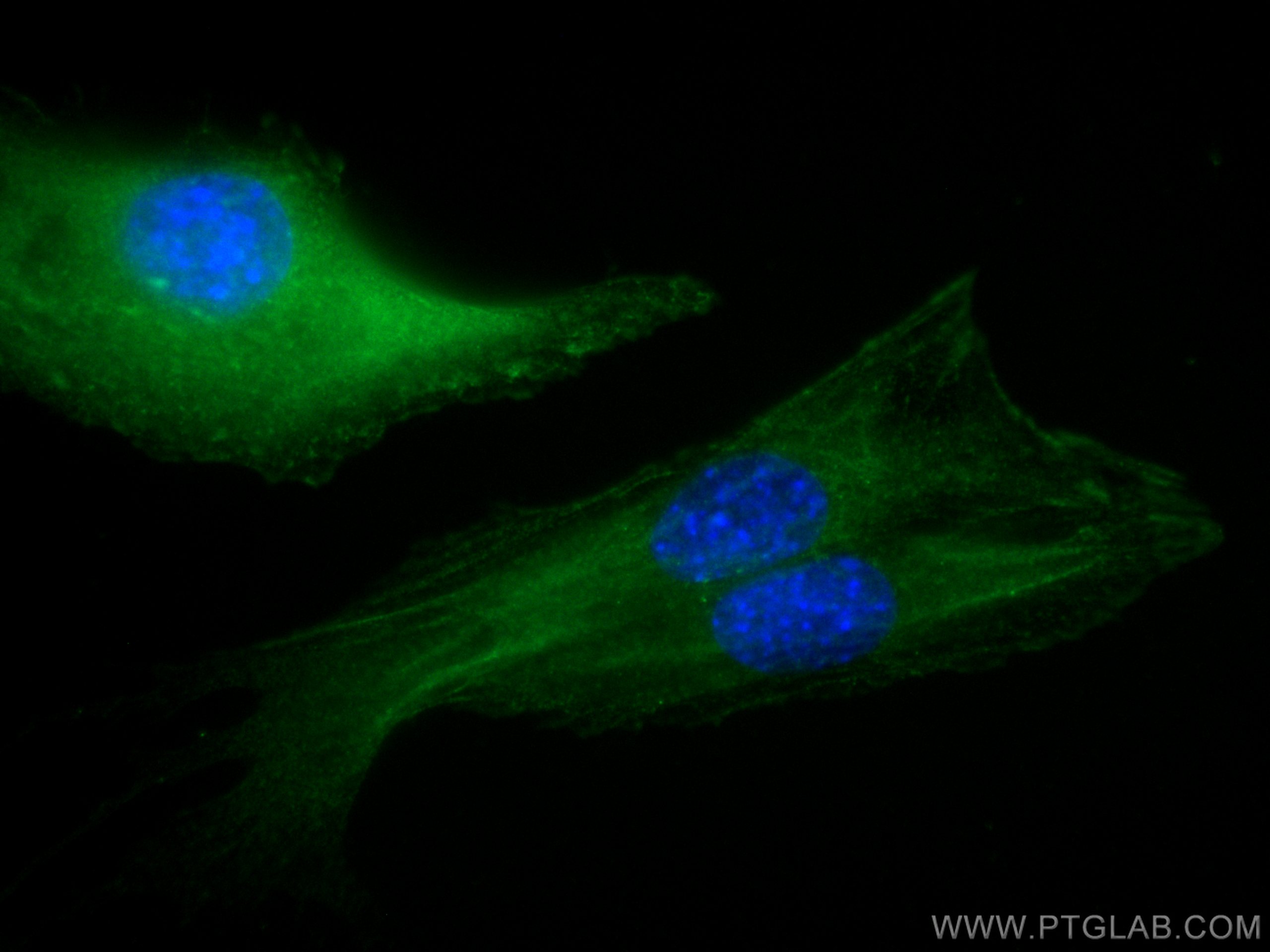 Immunofluorescence (IF) / fluorescent staining of C2C12 cells using Alpha Actinin Monoclonal antibody (66895-1-Ig)