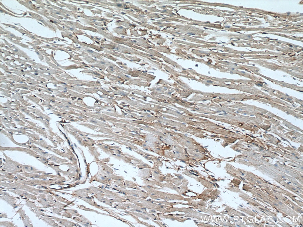 Immunohistochemistry (IHC) staining of mouse heart tissue using Alpha Actinin Monoclonal antibody (66895-1-Ig)