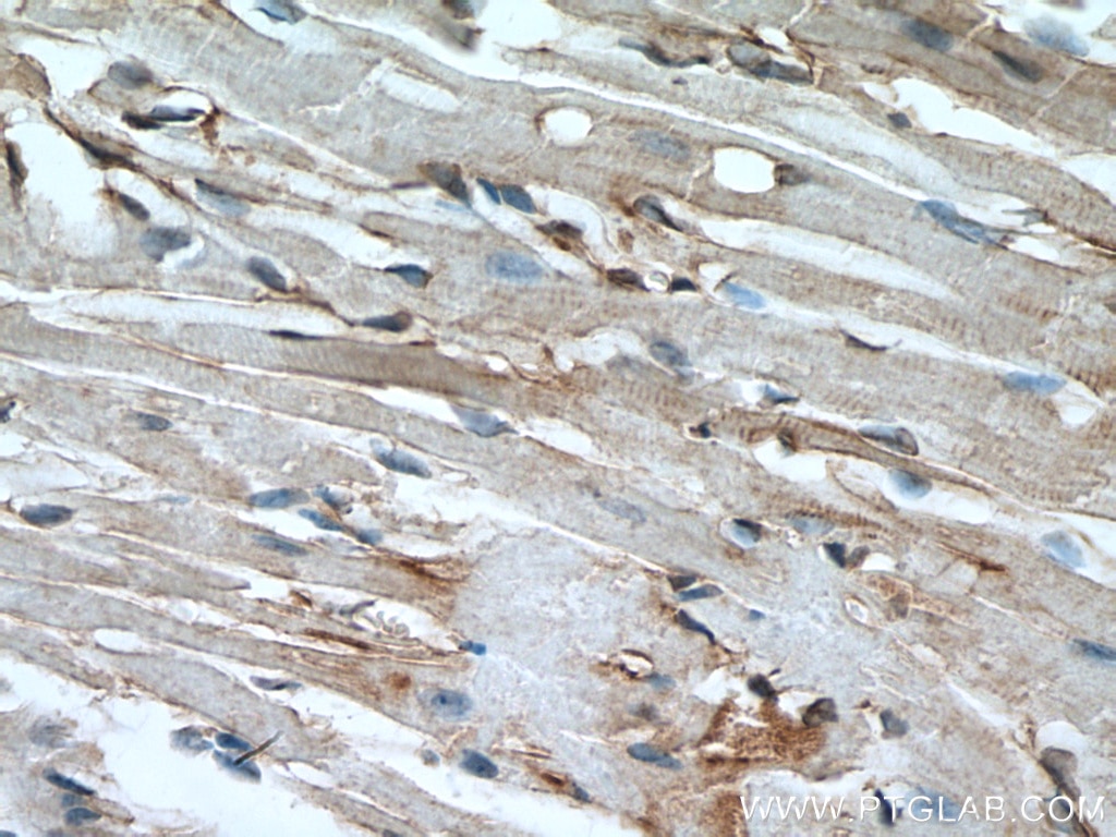 Immunohistochemistry (IHC) staining of mouse heart tissue using Alpha Actinin Monoclonal antibody (66895-1-Ig)