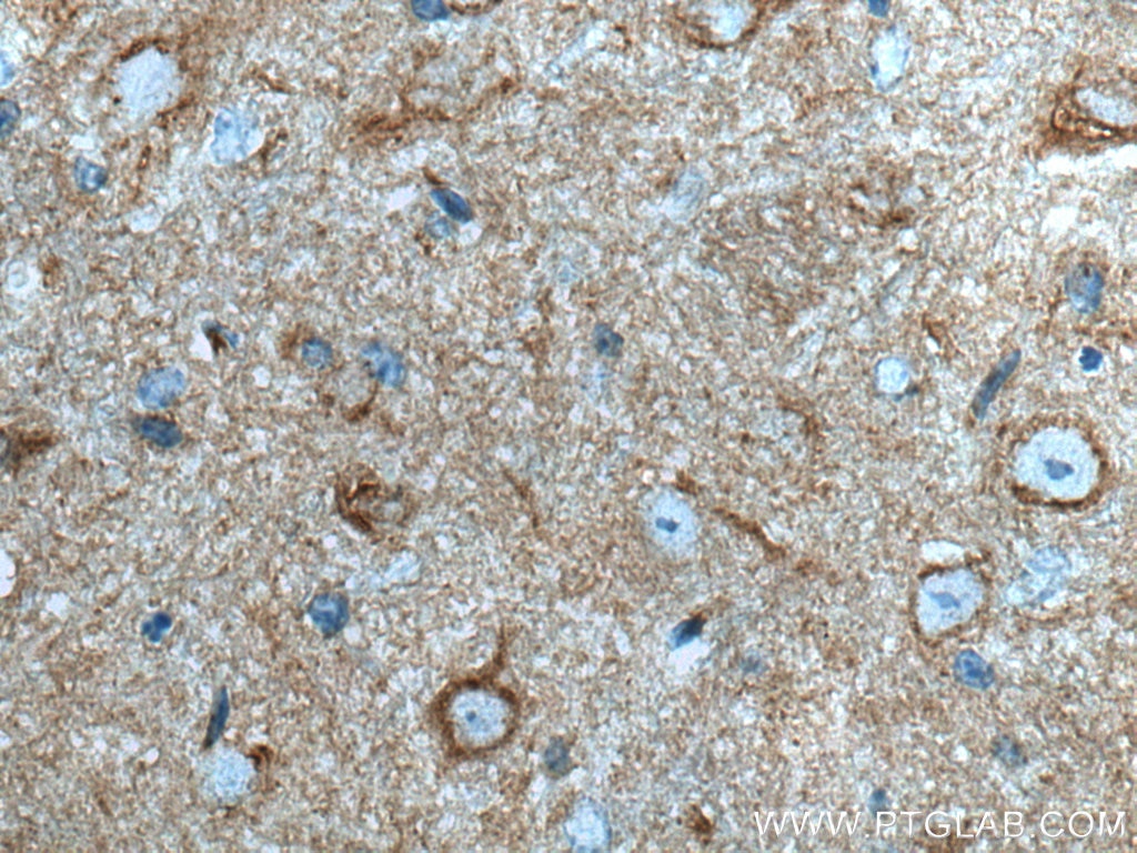 Immunohistochemistry (IHC) staining of mouse cerebellum tissue using Alpha SNAP Monoclonal antibody (67323-1-Ig)