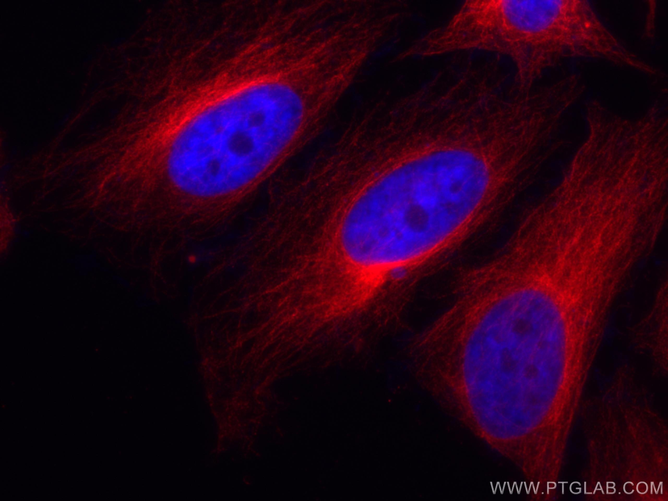 IF Staining of HeLa using CL594-66031