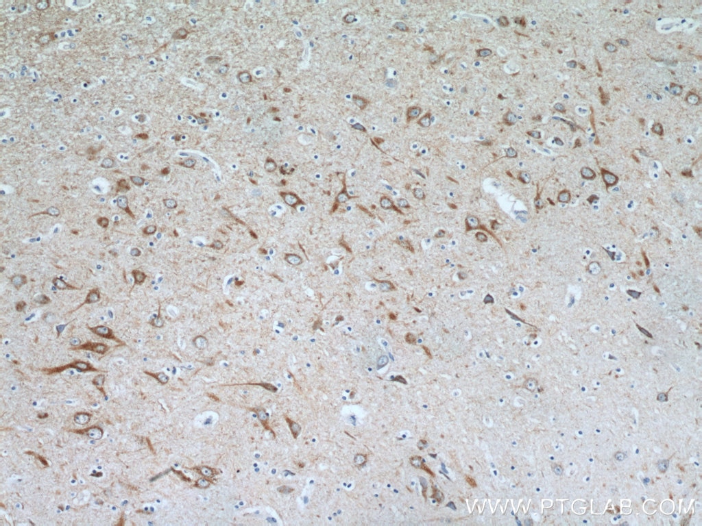 Immunohistochemistry (IHC) staining of human brain tissue using Alpha Internexin Polyclonal antibody (23881-1-AP)