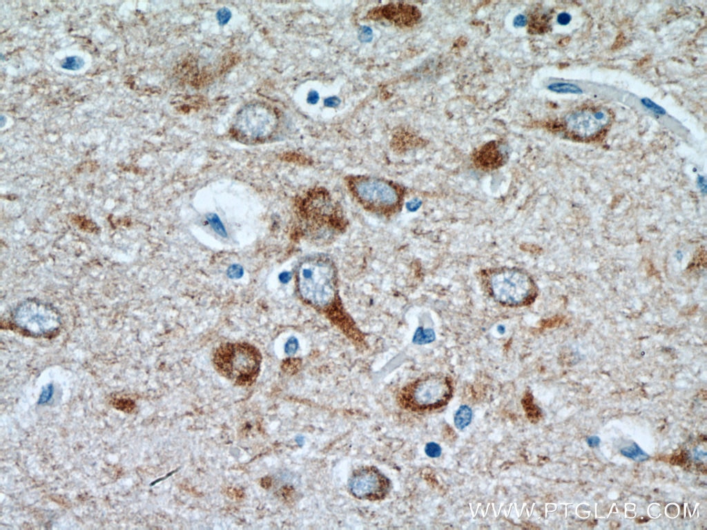 Immunohistochemistry (IHC) staining of human brain tissue using Alpha Internexin Polyclonal antibody (23881-1-AP)