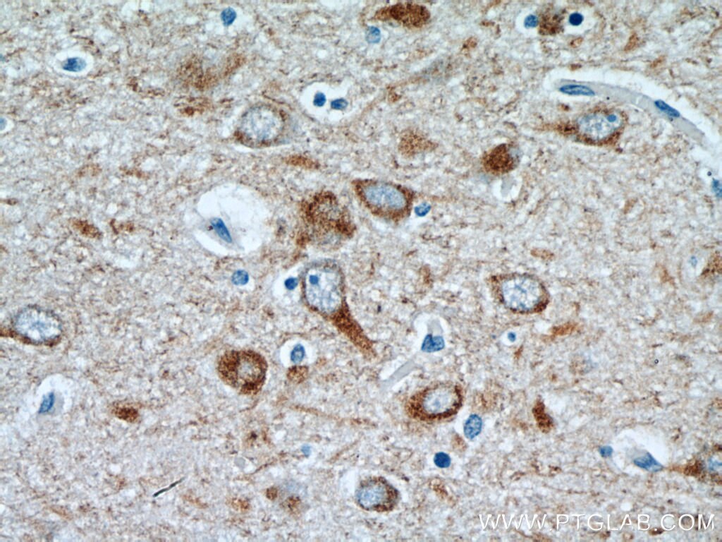 IHC staining of human brain using 23881-1-AP