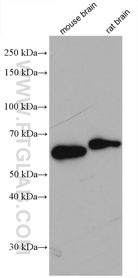 Western Blot (WB) analysis of various lysates using Alpha Internexin Polyclonal antibody (23881-1-AP)