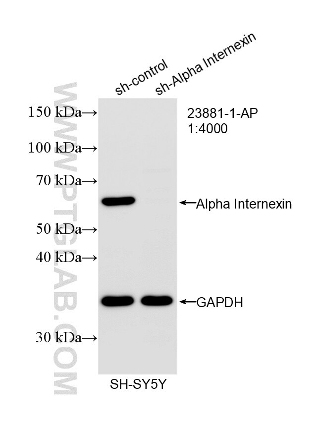 Western Blot (WB) analysis of SH-SY5Y cells using Alpha Internexin Polyclonal antibody (23881-1-AP)