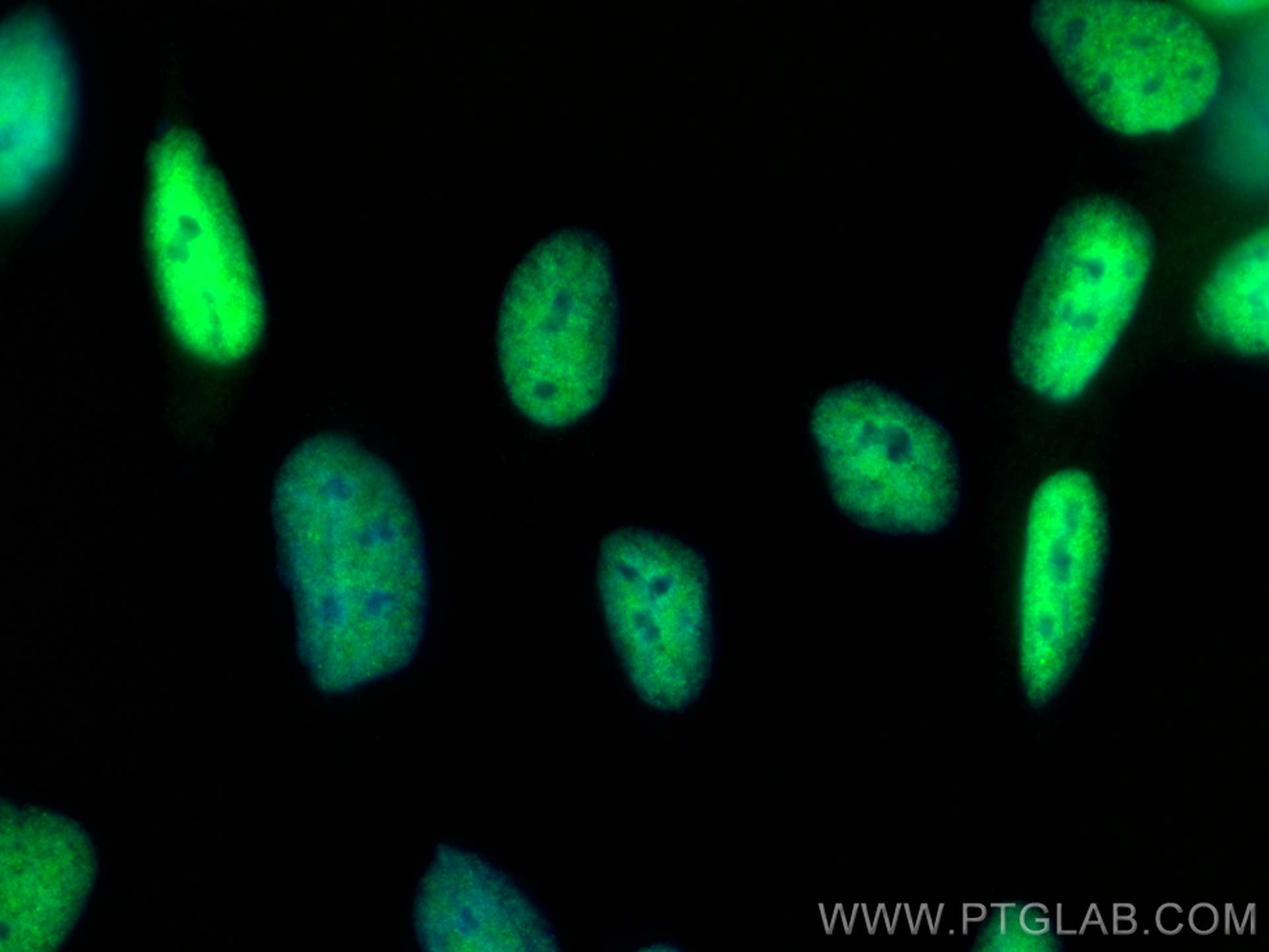 Immunofluorescence (IF) / fluorescent staining of LNCaP cells using androgen receptor Recombinant antibody (81844-1-RR)
