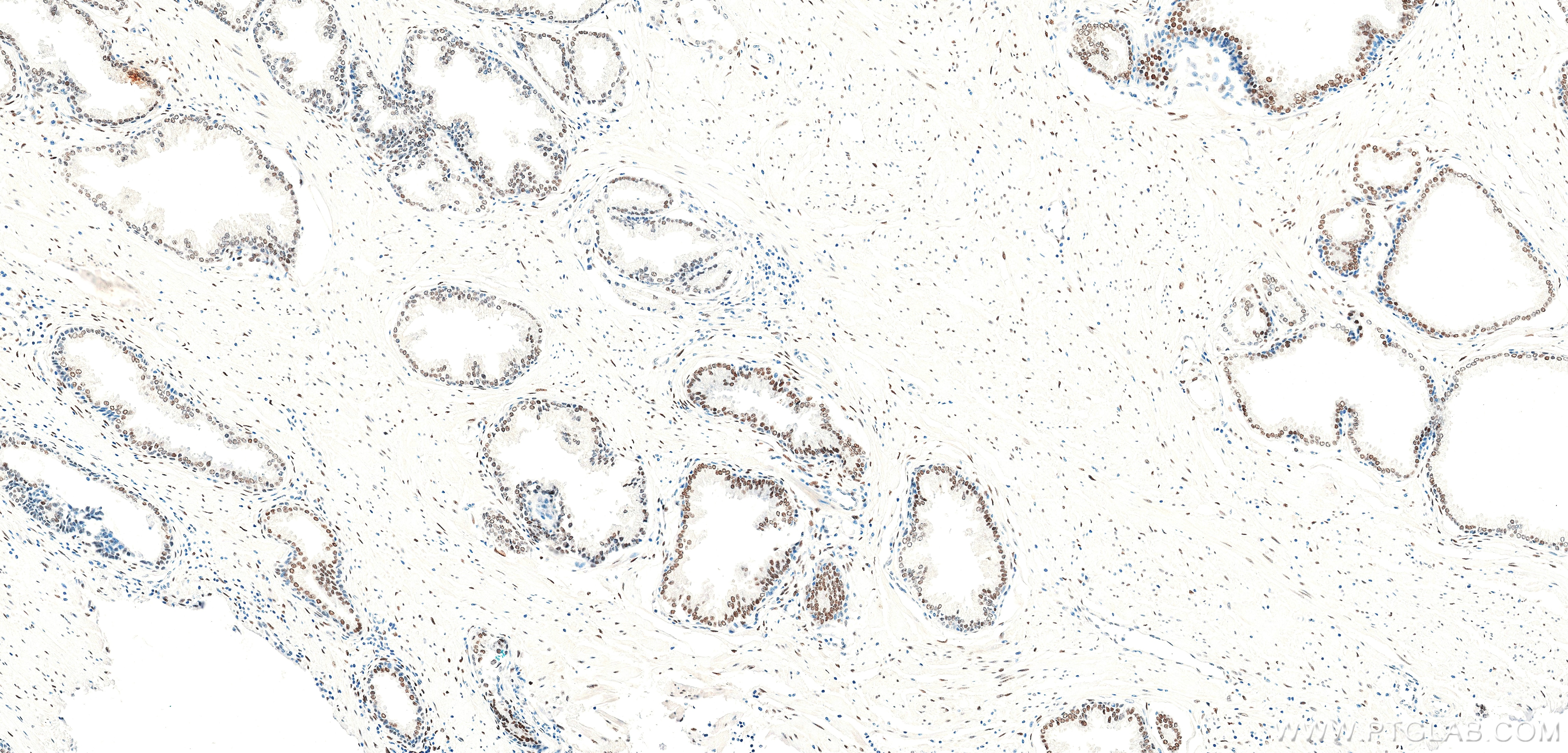 Immunohistochemistry (IHC) staining of human prostate tissue using androgen receptor Recombinant monoclonal antibody (81844-1-RR)