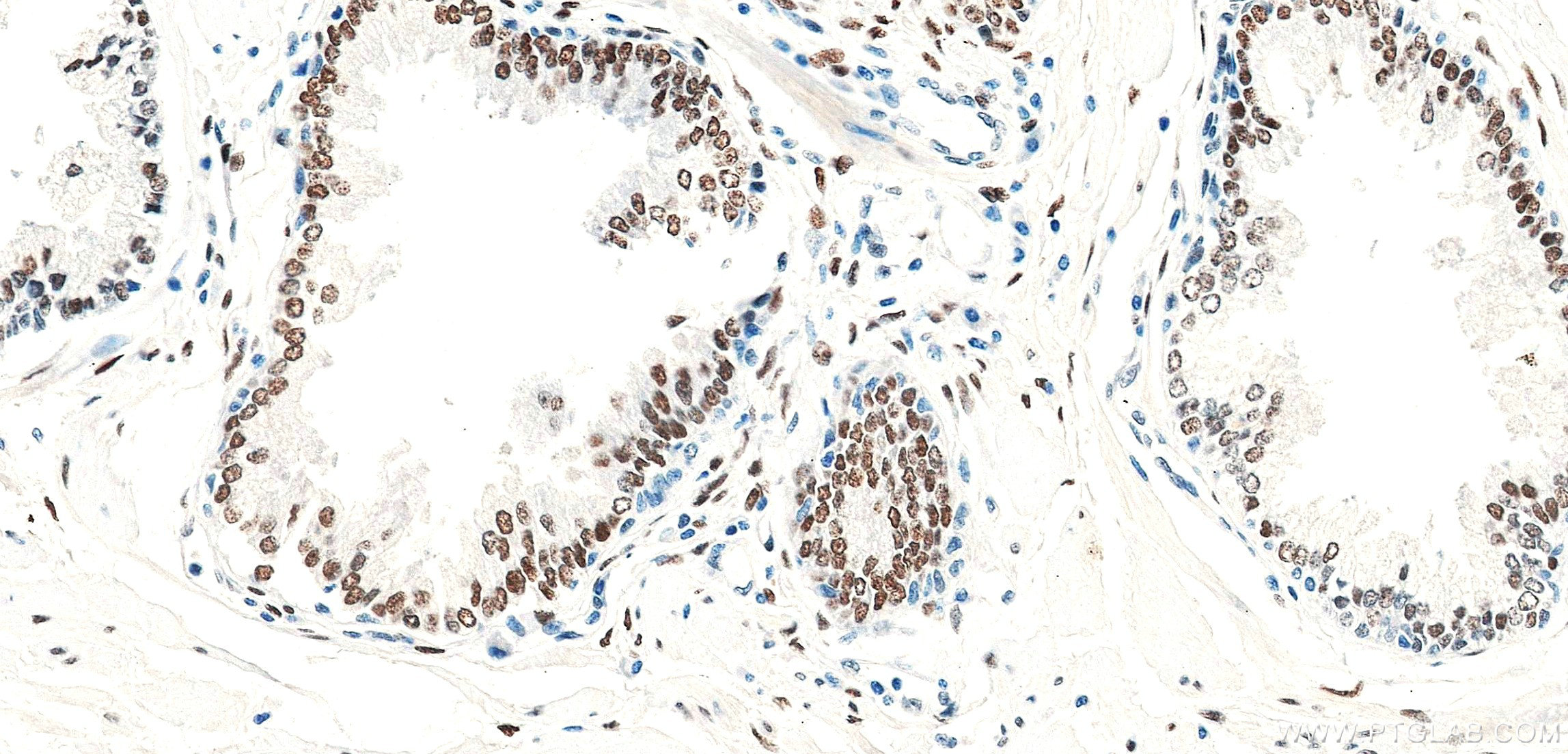Immunohistochemistry (IHC) staining of human prostate tissue using androgen receptor Recombinant monoclonal antibody (81844-1-RR)