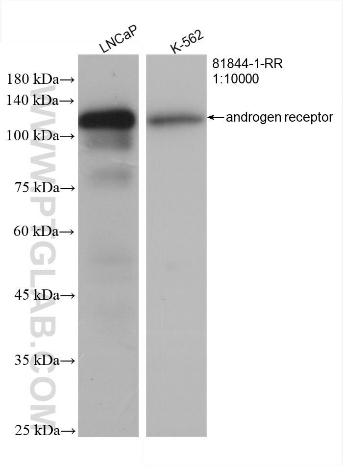 Western Blot (WB) analysis of various lysates using androgen receptor Recombinant antibody (81844-1-RR)