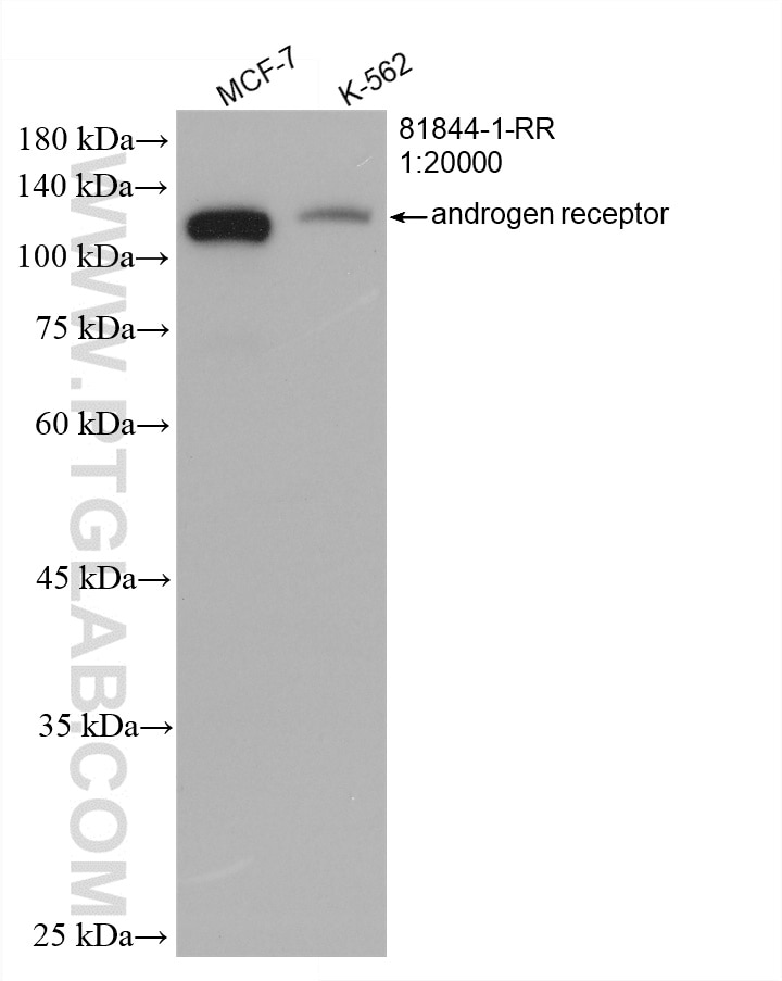 Western Blot (WB) analysis of various lysates using androgen receptor Recombinant antibody (81844-1-RR)