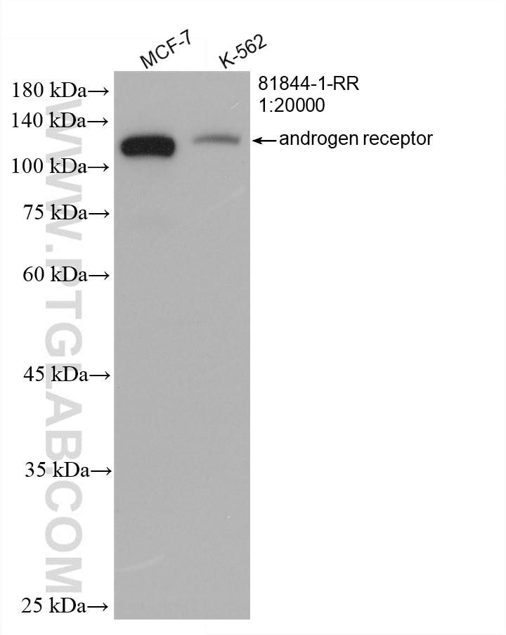 WB analysis using 81844-1-RR