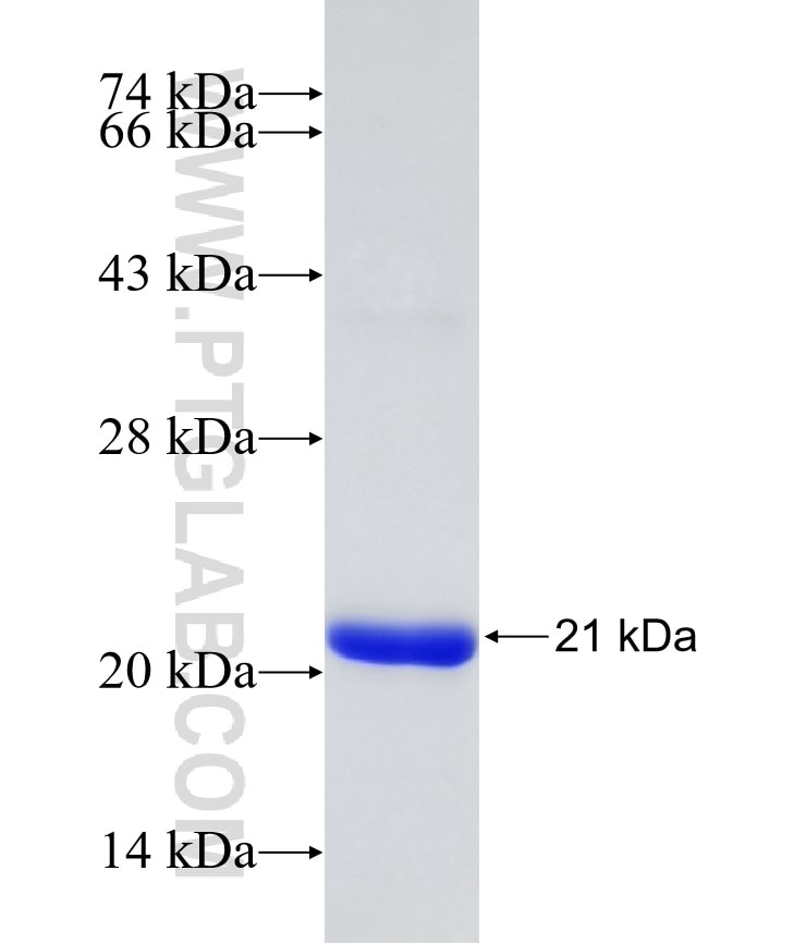 apcA fusion protein Ag31849 SDS-PAGE apcA fusion protein Ag31849 SDS-PAGE