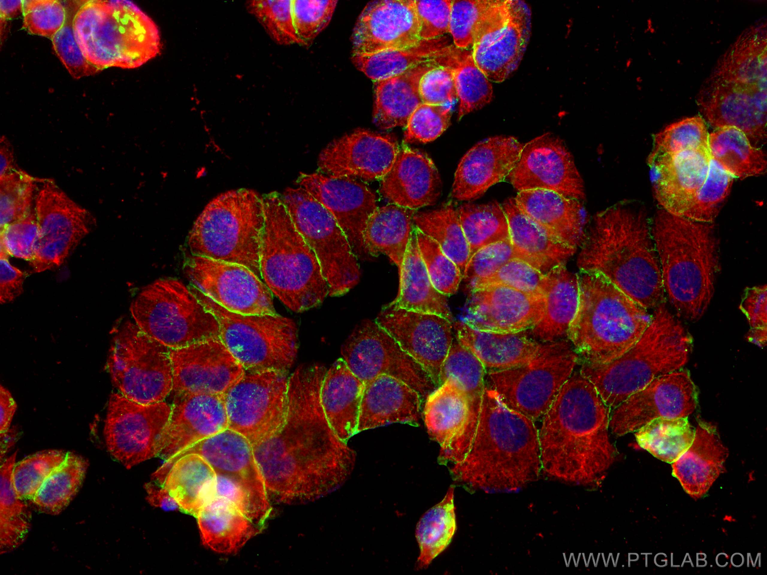 Immunofluorescence (IF) / fluorescent staining of T-47D cells using Beta Catenin Polyclonal antibody (17565-1-AP)