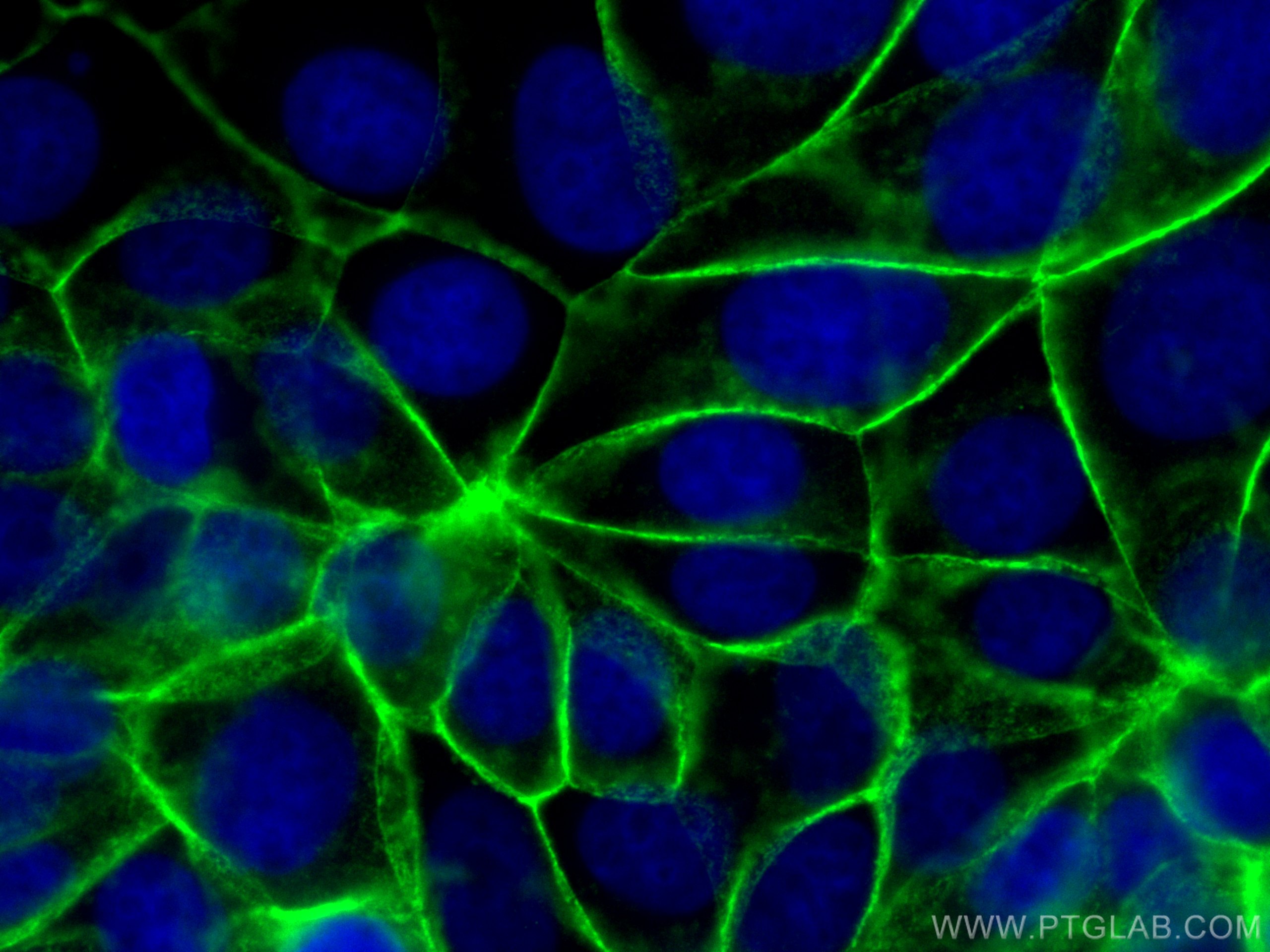 Immunofluorescence (IF) / fluorescent staining of MCF-7 cells using Beta Catenin Polyclonal antibody (17565-1-AP)