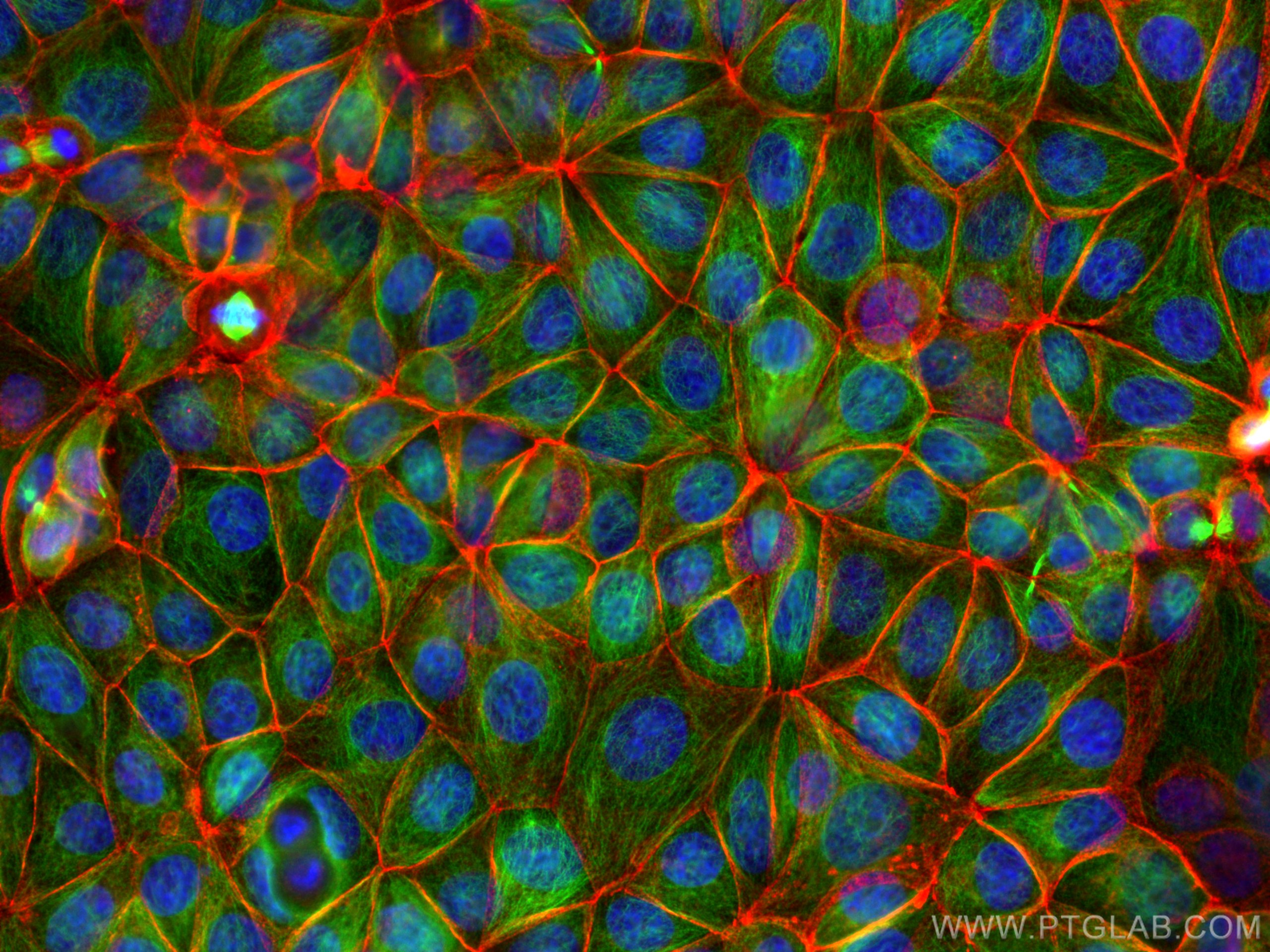 Immunofluorescence (IF) / fluorescent staining of MCF-7 cells using Beta Catenin Polyclonal antibody (17565-1-AP)