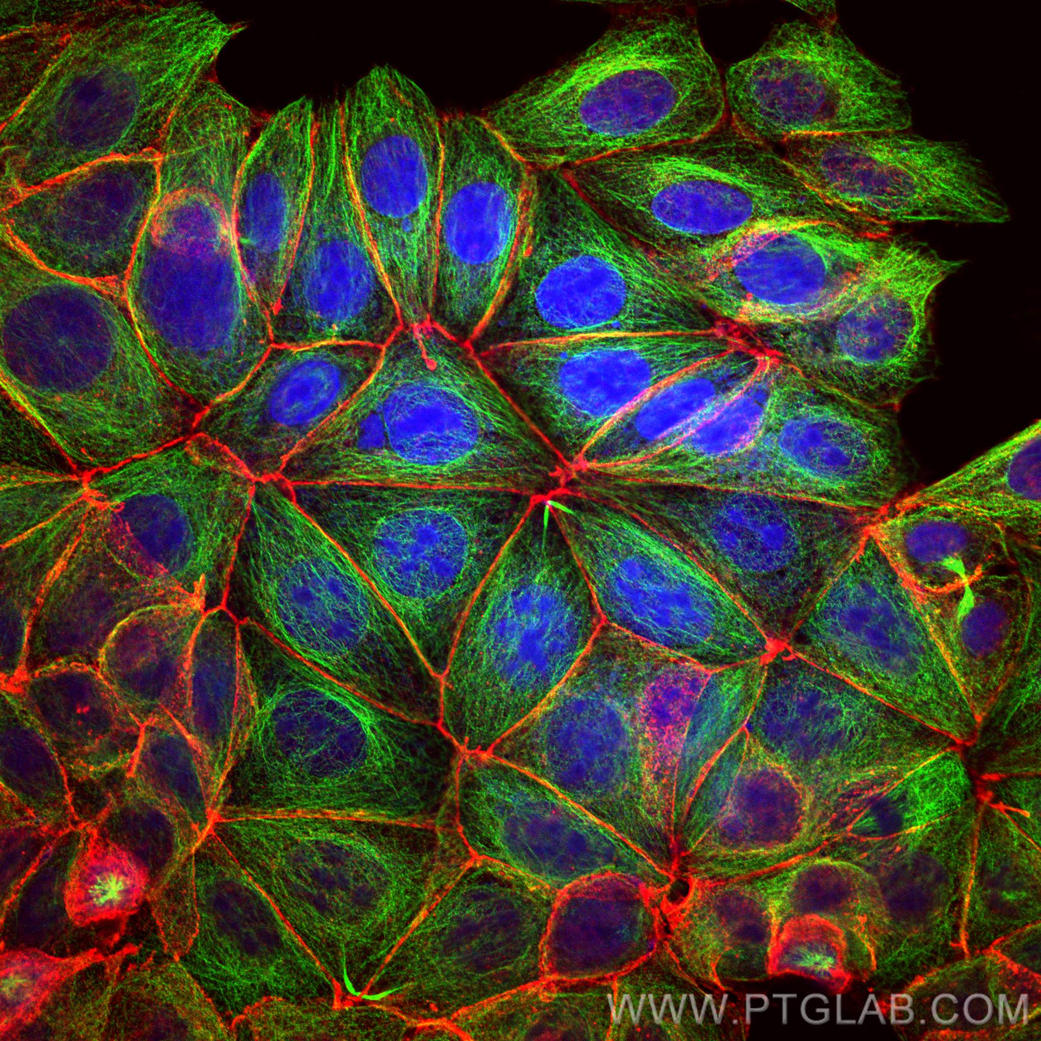 IF Staining of MCF-7 using 17565-1-AP