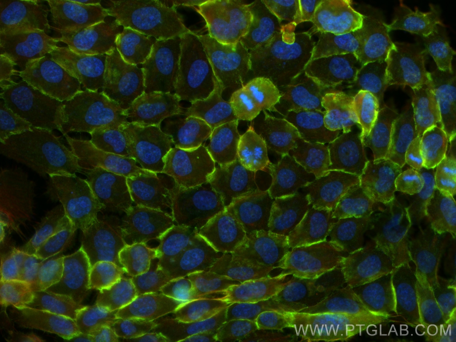 Immunofluorescence (IF) / fluorescent staining of U-251 cells using Beta Catenin Polyclonal antibody (17565-1-AP)
