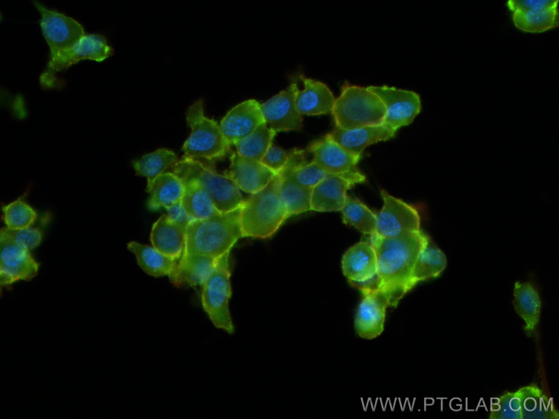IF Staining of U-87 MG using 17565-1-AP Immunofluorescence (IF) / fluorescent staining of U-87 MG cells using Beta Catenin Polyclonal antibody (17565-1-AP)