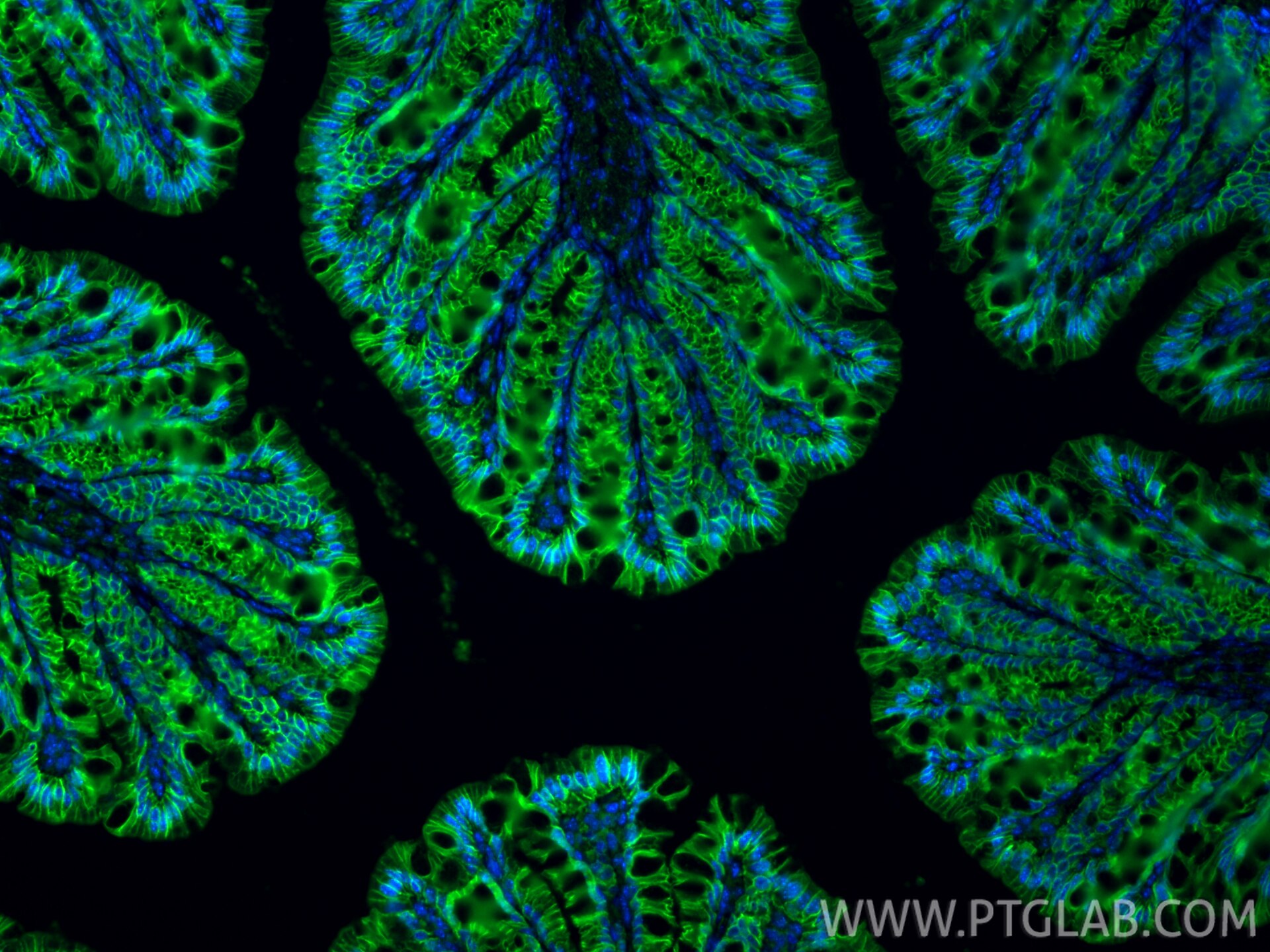 Immunofluorescence (IF) / fluorescent staining of mouse colon tissue using Beta Catenin Polyclonal antibody (17565-1-AP)