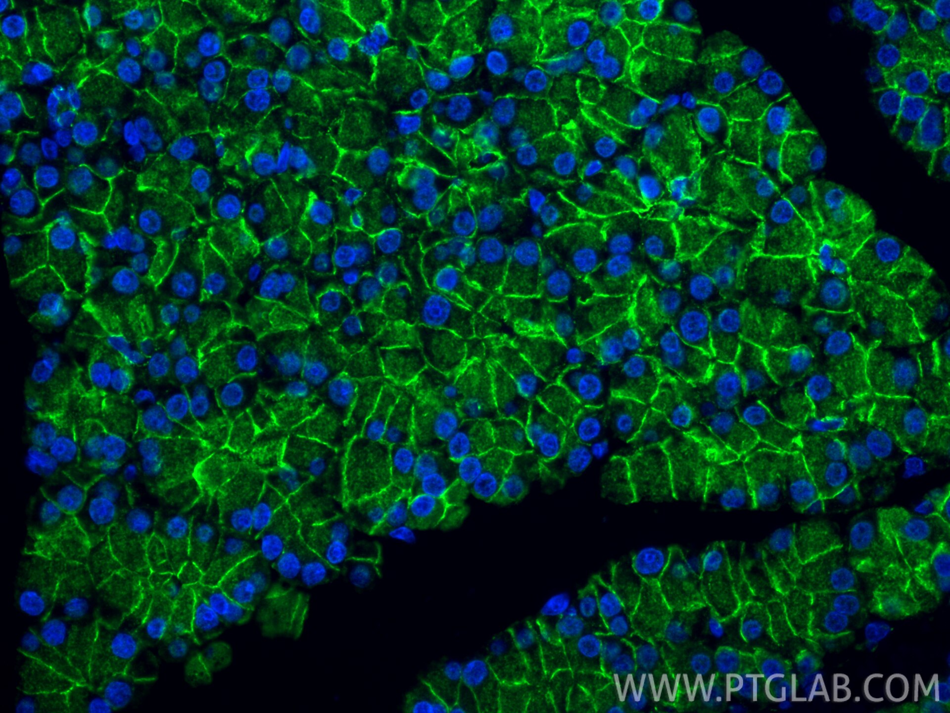 Immunofluorescence (IF) / fluorescent staining of rat pancreas tissue using Beta Catenin Polyclonal antibody (17565-1-AP)