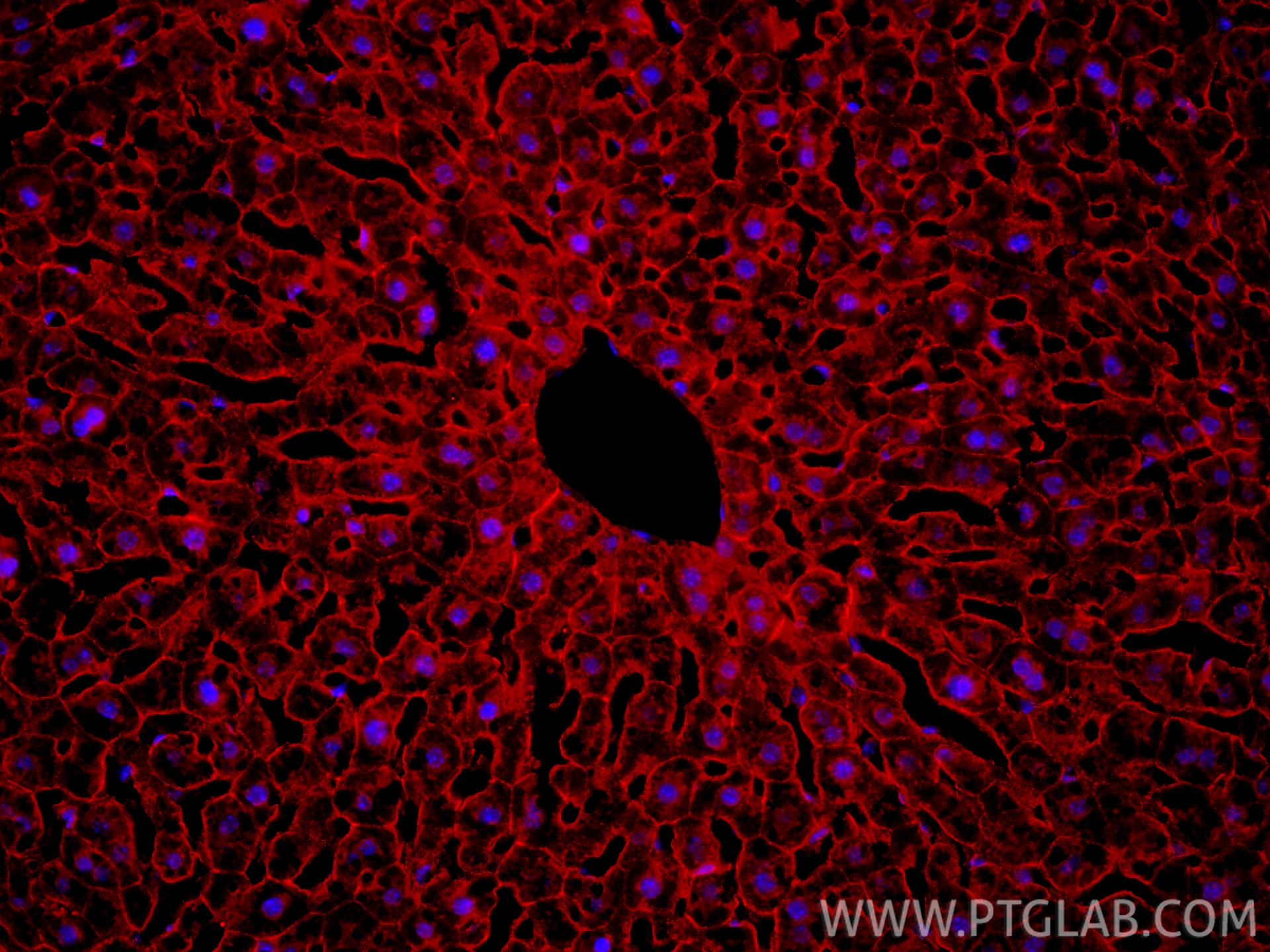 IF Staining of mouse liver using 17565-1-AP Immunofluorescence (IF) / fluorescent staining of mouse liver tissue using Beta Catenin Polyclonal antibody (17565-1-AP)