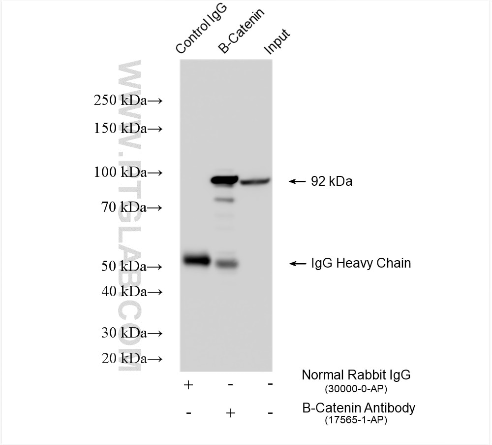 Immunoprecipitation (IP) experiment of HEK-293 cells using Beta Catenin Polyclonal antibody (17565-1-AP)