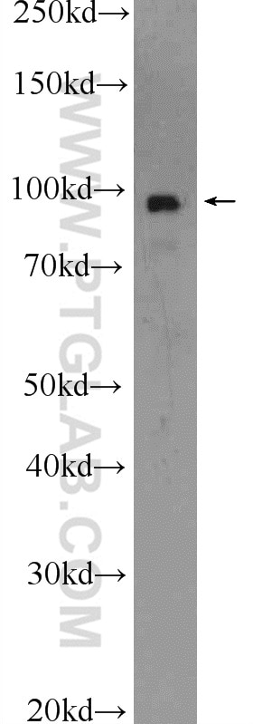 Western Blot (WB) analysis of NIH/3T3 cells using Beta Catenin Polyclonal antibody (17565-1-AP)