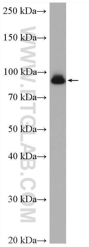 Western Blot (WB) analysis of HEK-293 cells using Beta Catenin Polyclonal antibody (17565-1-AP)