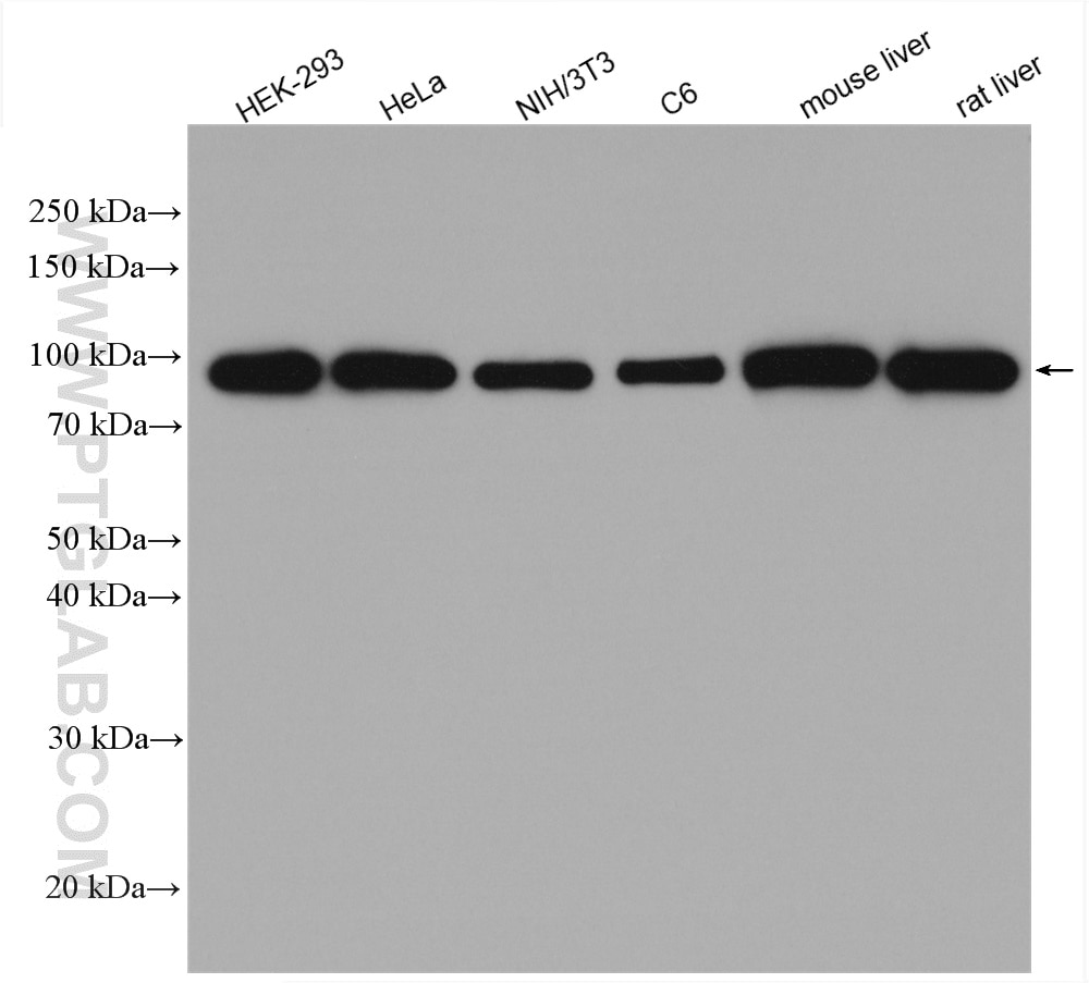 Western Blot (WB) analysis of various lysates using Beta Catenin Polyclonal antibody (17565-1-AP)