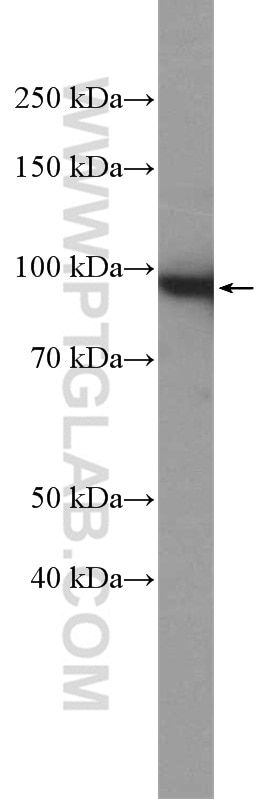 Western Blot (WB) analysis of HeLa cells using Beta Catenin Polyclonal antibody (17565-1-AP)