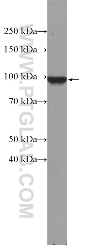 Western Blot (WB) analysis of mouse brain tissue using Beta Catenin Polyclonal antibody (17565-1-AP)