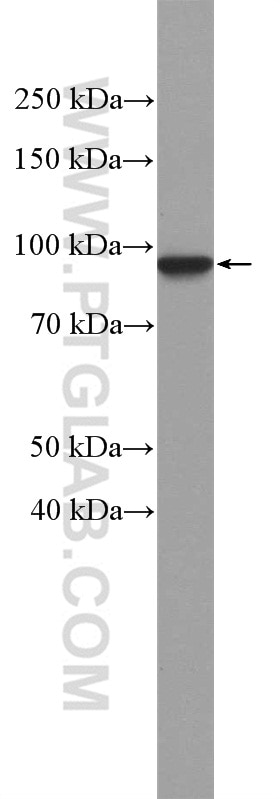 Western Blot (WB) analysis of A431 cells using Beta Catenin Polyclonal antibody (17565-1-AP)
