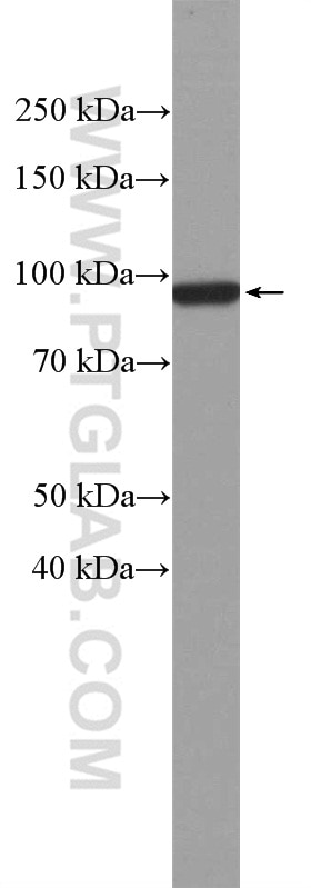 Western Blot (WB) analysis of MCF-7 cells using Beta Catenin Polyclonal antibody (17565-1-AP)