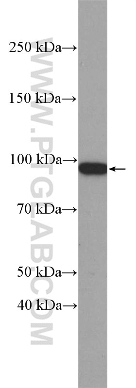 Western Blot (WB) analysis of mouse liver tissue using Beta Catenin Polyclonal antibody (17565-1-AP)