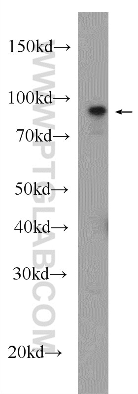 Western Blot (WB) analysis of rat brain tissue using Beta Catenin Polyclonal antibody (17565-1-AP)