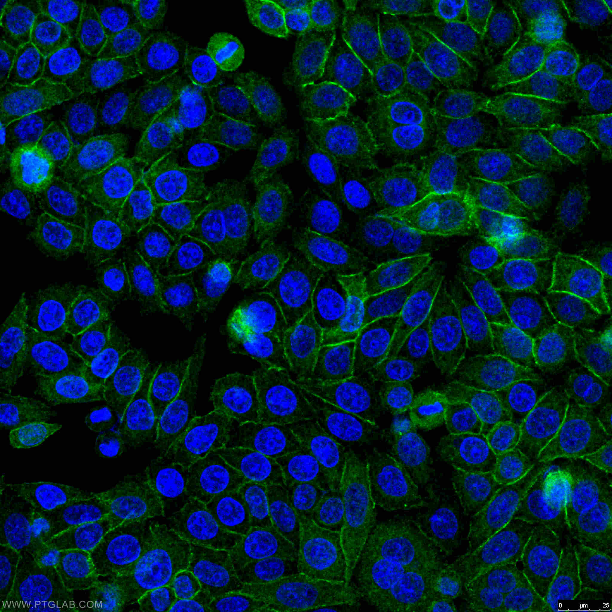 Immunofluorescence (IF) / fluorescent staining of HeLa cells using Beta Catenin Polyclonal antibody (51067-2-AP)