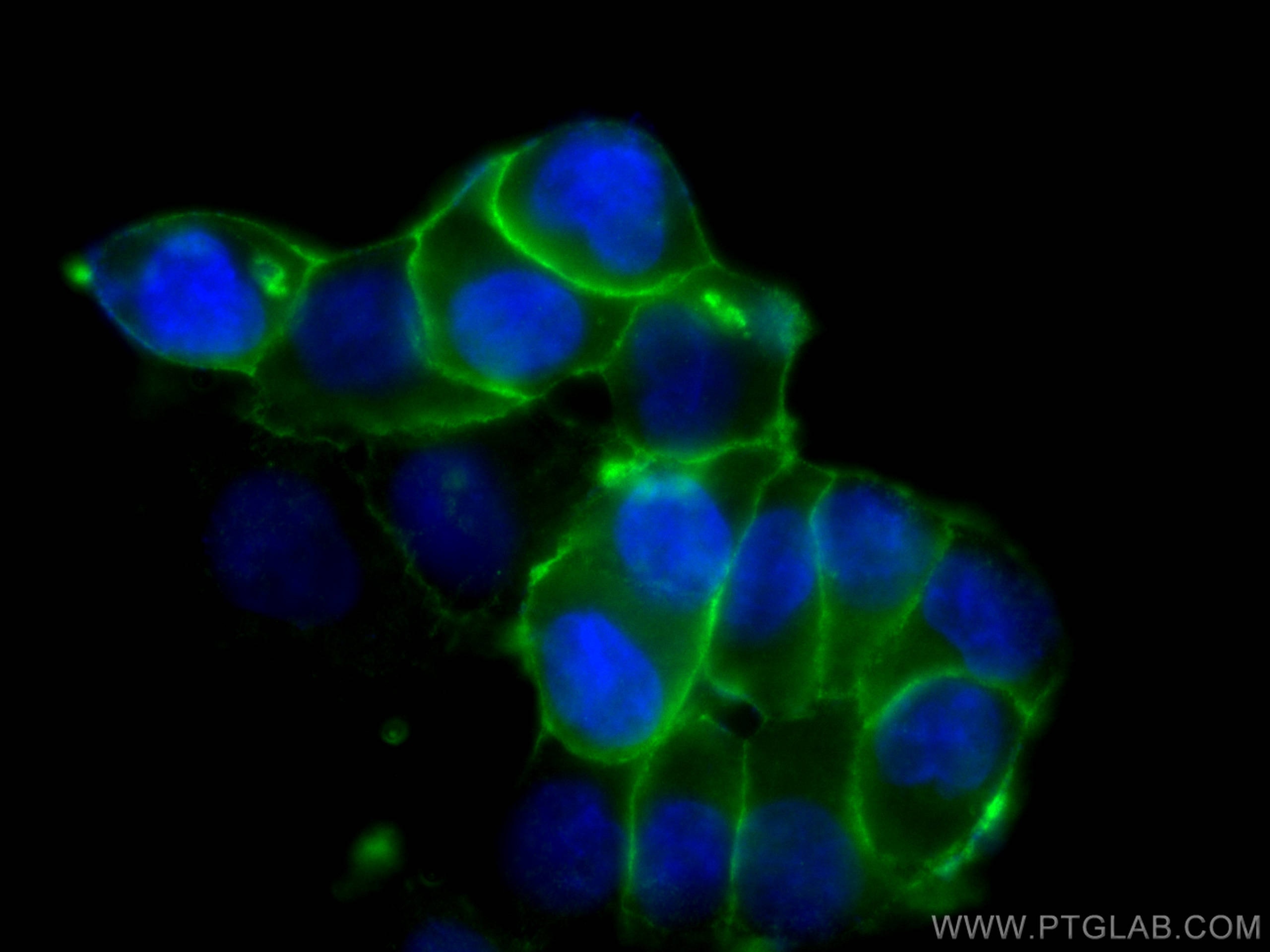 Immunofluorescence (IF) / fluorescent staining of T-47D cells using Beta Catenin Polyclonal antibody (51067-2-AP)