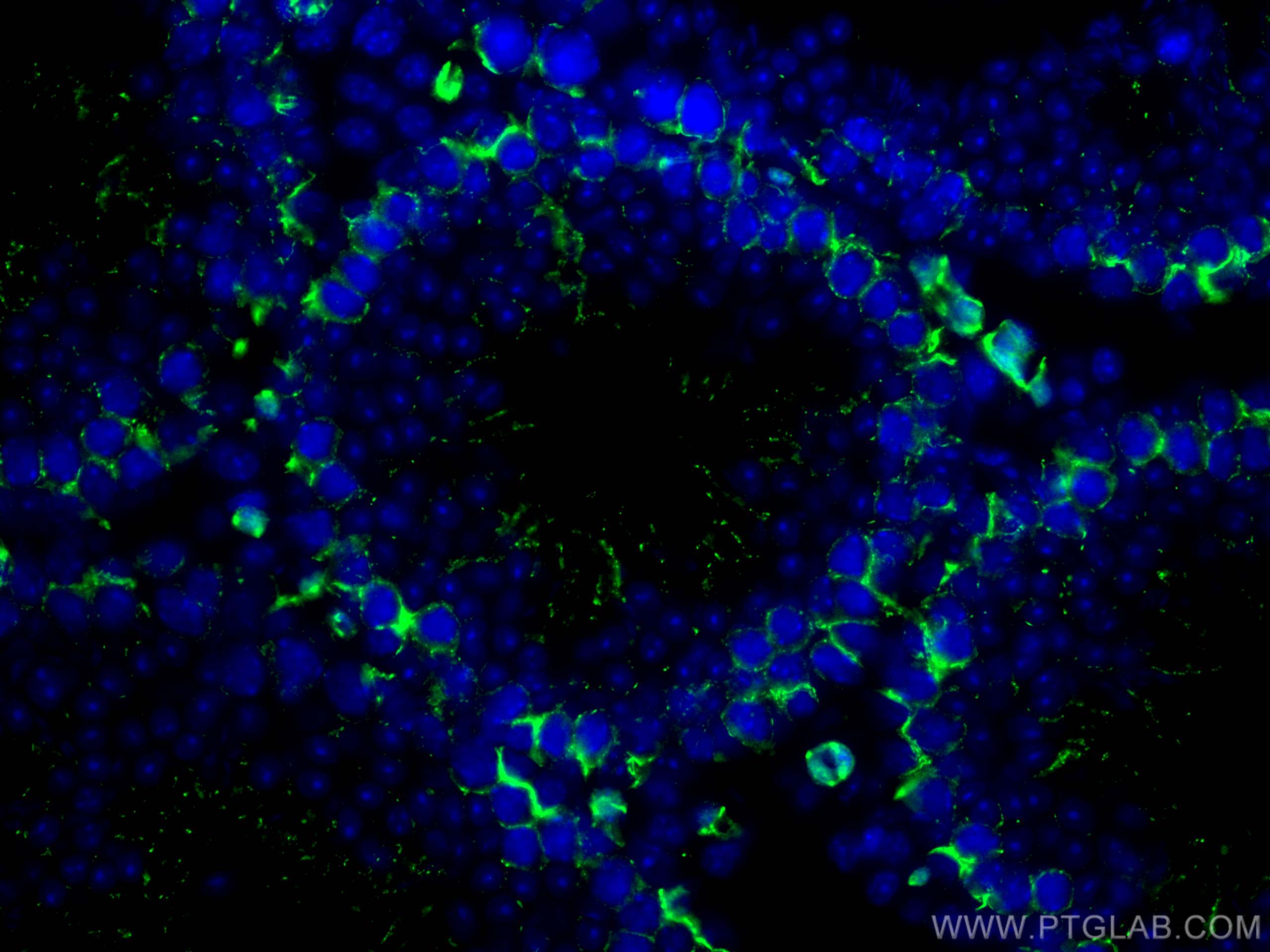 Immunofluorescence (IF) / fluorescent staining of mouse testis tissue using Beta Catenin Polyclonal antibody (51067-2-AP)