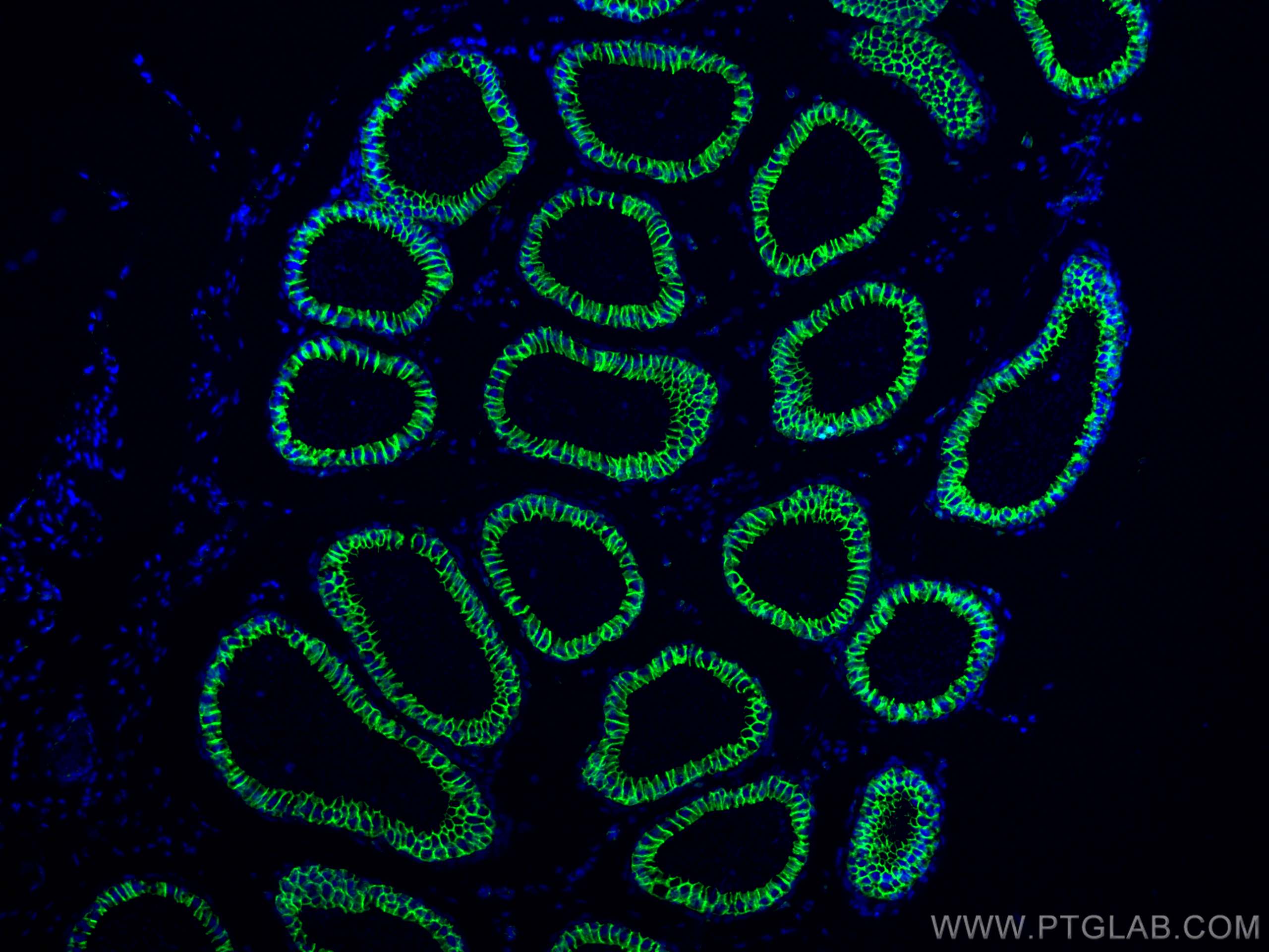 IF Staining of mouse testis using 51067-2-AP
