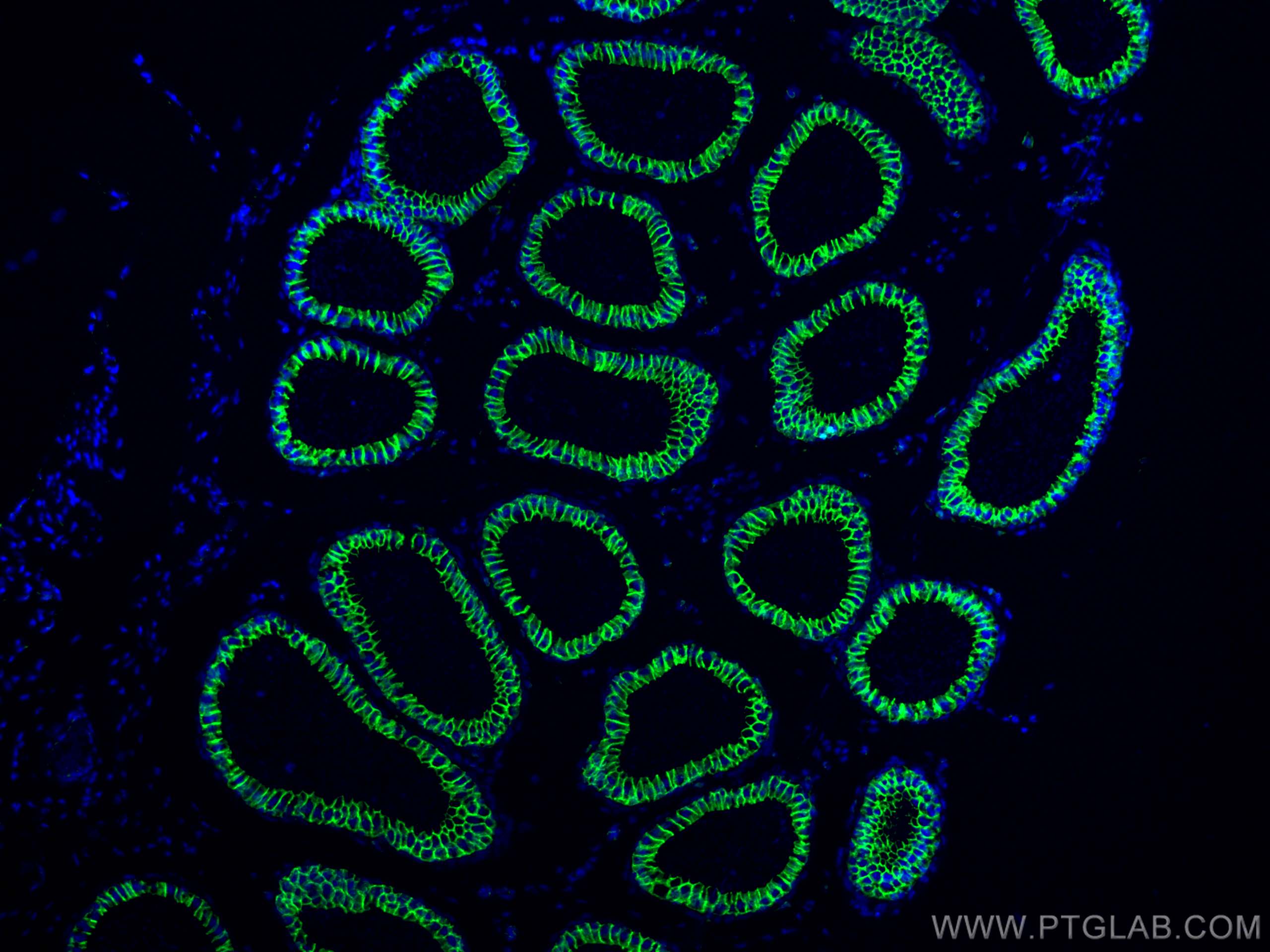 Immunofluorescence (IF) / fluorescent staining of mouse testis tissue using Beta Catenin Polyclonal antibody (51067-2-AP)